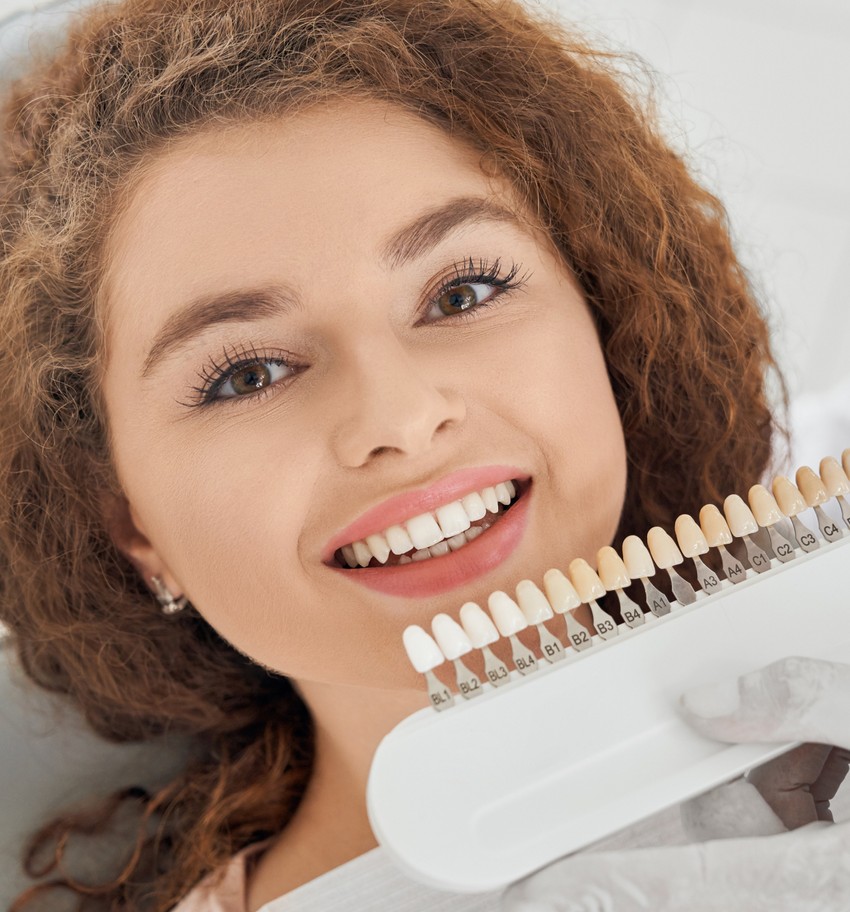 in office whitening